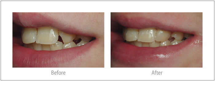 Wesley - Orthodontics &amp; Composite Bonding