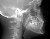 ortho cephalometric xray