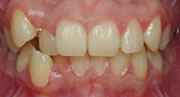 orthodontics