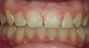 children's orthodontics